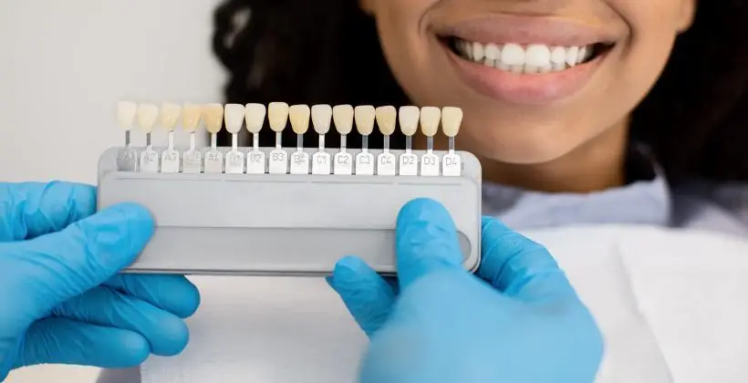 Veneers prices in Turkey